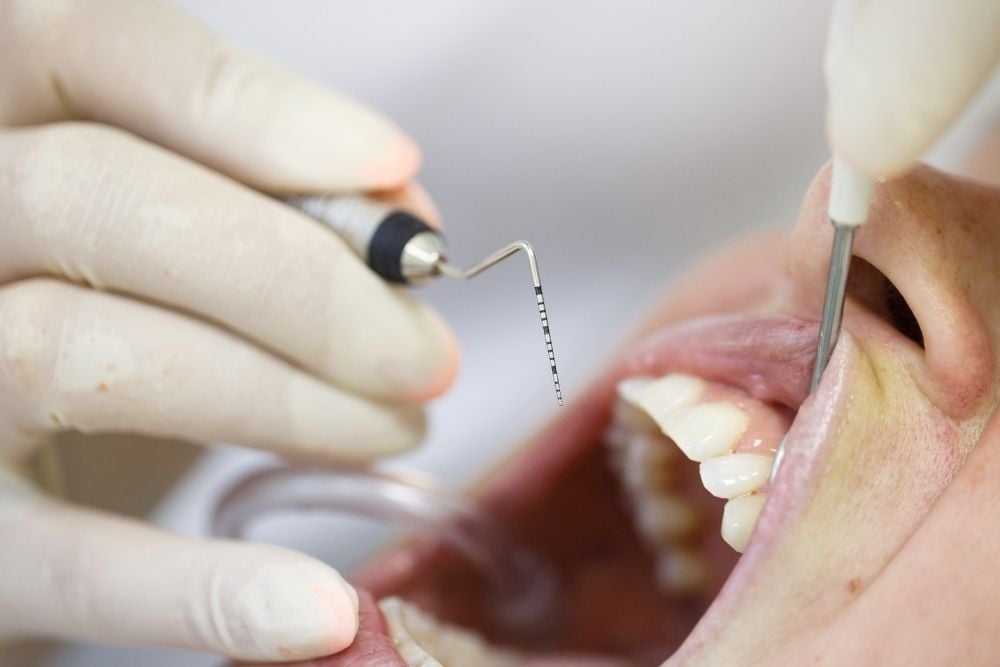 Bolsas periodontales / Ester Rodríguez Clínica Dental