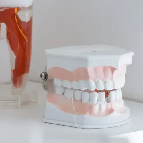 Protésis Dental - Ester Clínica Dental