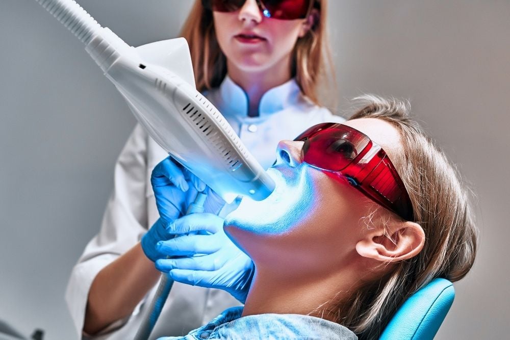 ¿Cuánto dura un blanqueamiento dental profesional? - Ester Rodríguez Clínica Dental