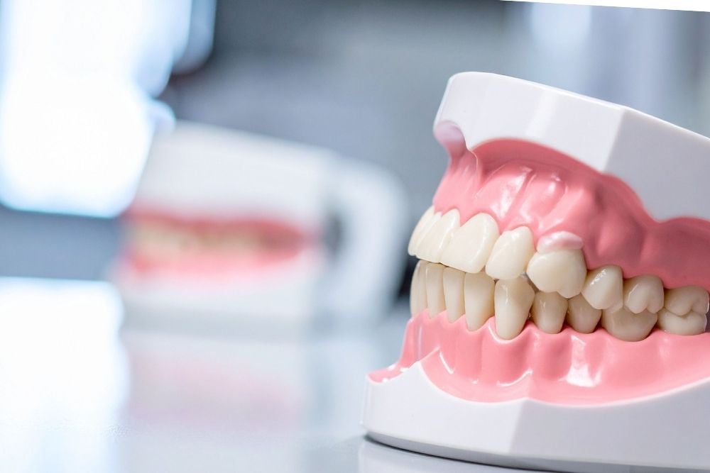 Descalcificación de dientes / Ester Rodríguez Clínica Dental