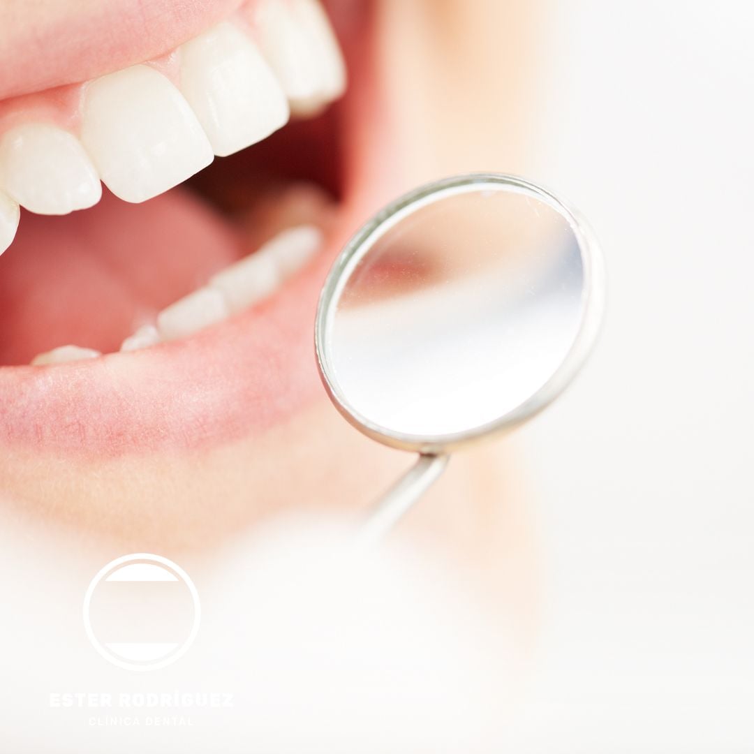 Limpieza dental en Salamanca | Ester Clínica Dental