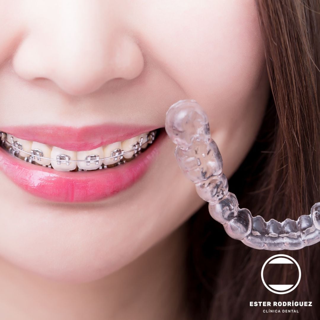 Ortodoncia en Salamanca | Ester Rodríguez Clínica Dental