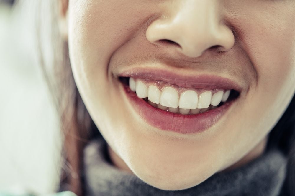 Cómo arreglar dientes separados y mejorar tu sonrisa / Ester Rodriguez Clínica Dental
