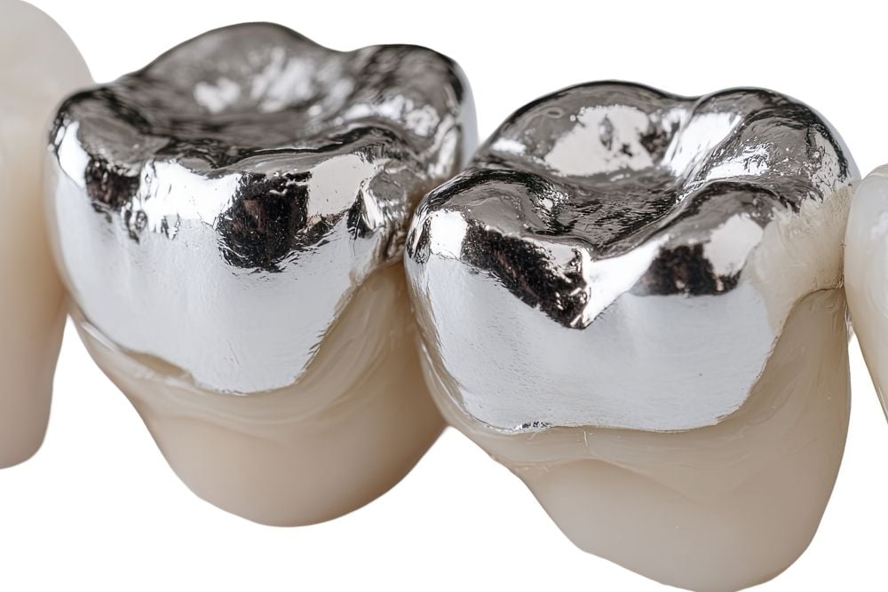 Diferencia entre empaste y reconstrucción dental / Ester Rodriguez Clínica Dental