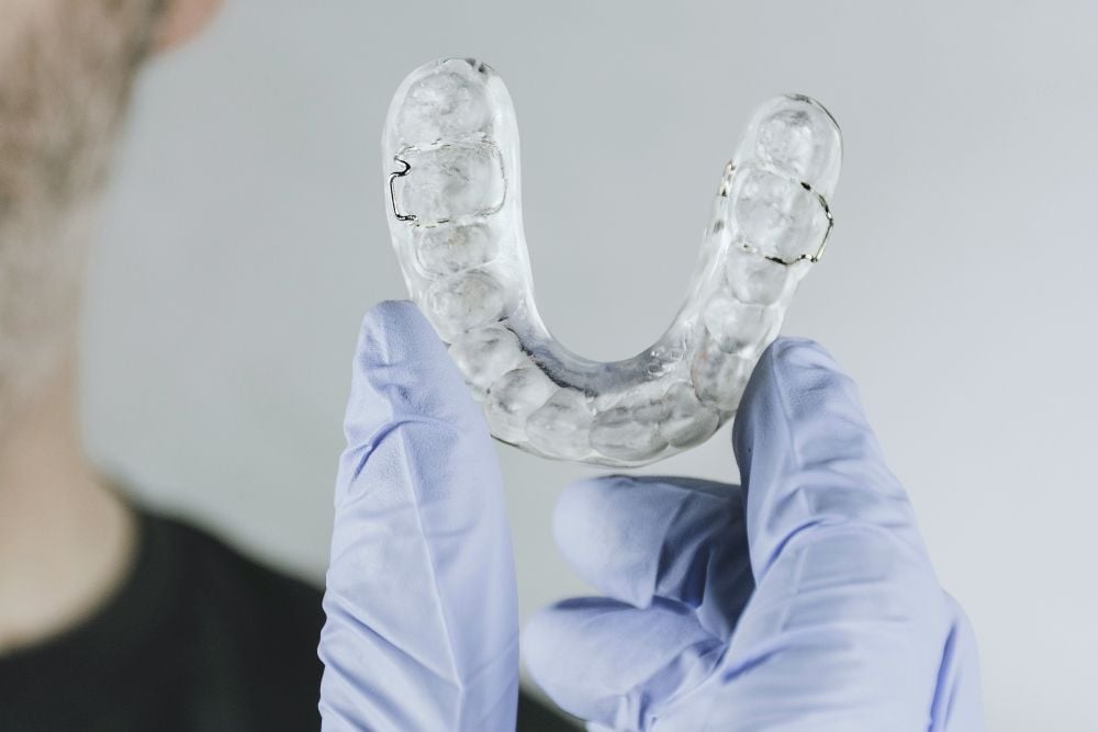Cómo limpiar férula dental de forma correcta | Ester Rodriguez Clínica Dental