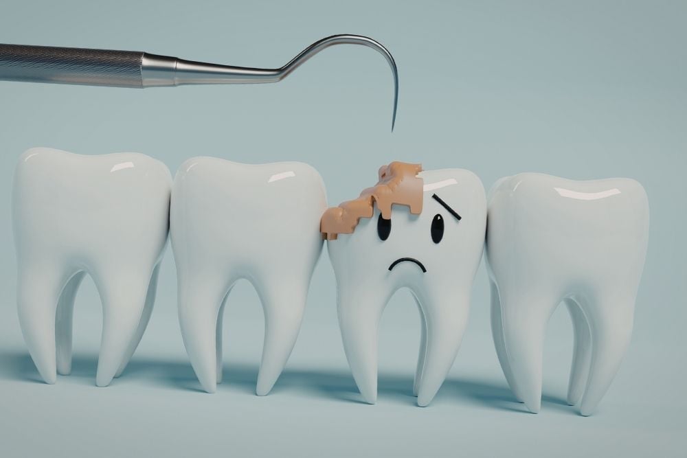 Esmalte dental dañado / Ester Rodríguez Clínica Dental