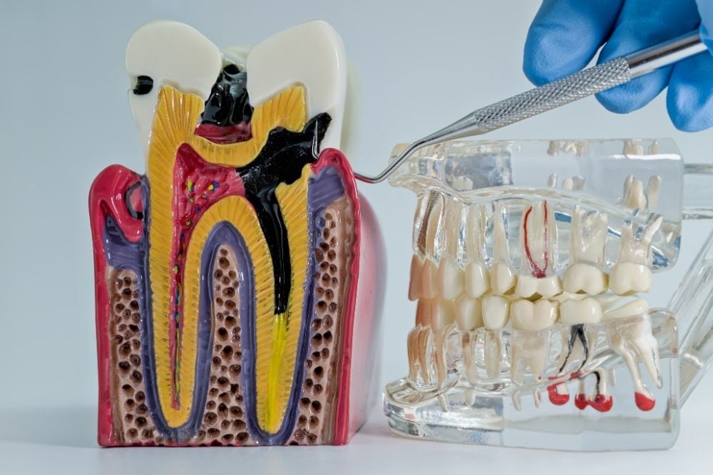 Exodoncia / Ester Rodríguez Clínica Dental