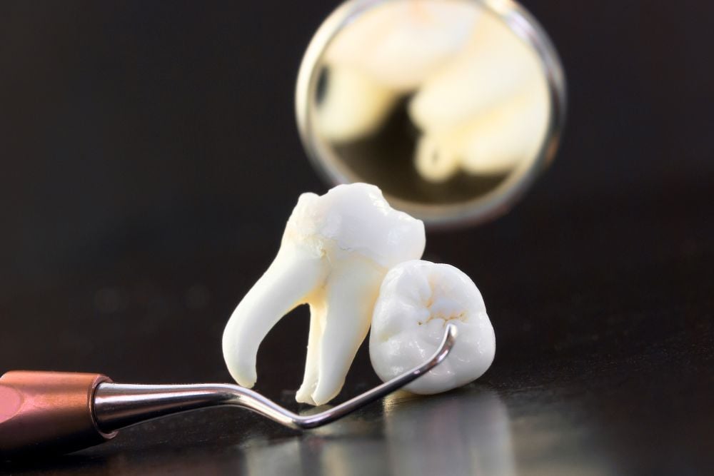 Extracción muela del juicio | Ester Rodríguez Clínica Dental en Salamanca