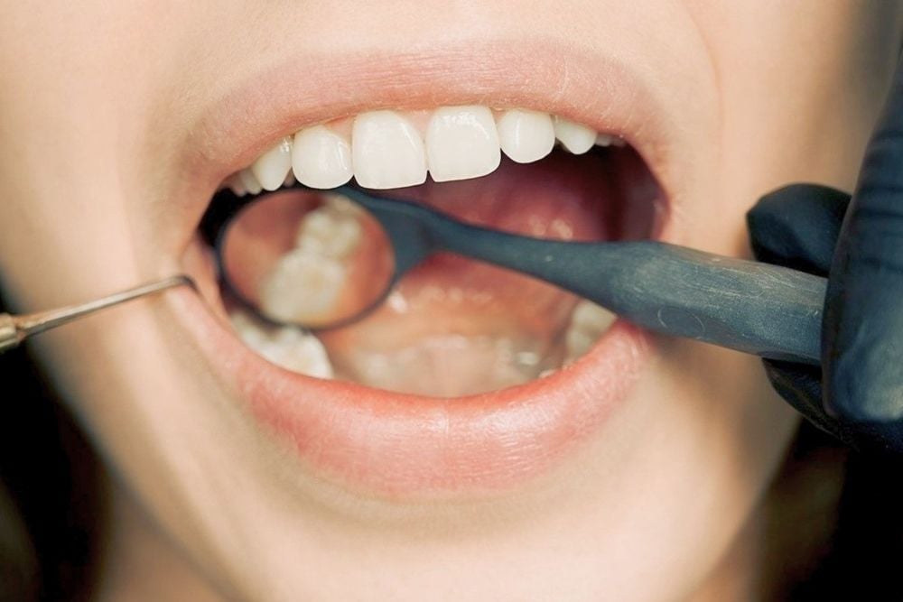 Mucoceles: qué son, causas y tratamientos en Clínica Dental Ester Rodríguez / Ester Rodriguez Clínica Dental