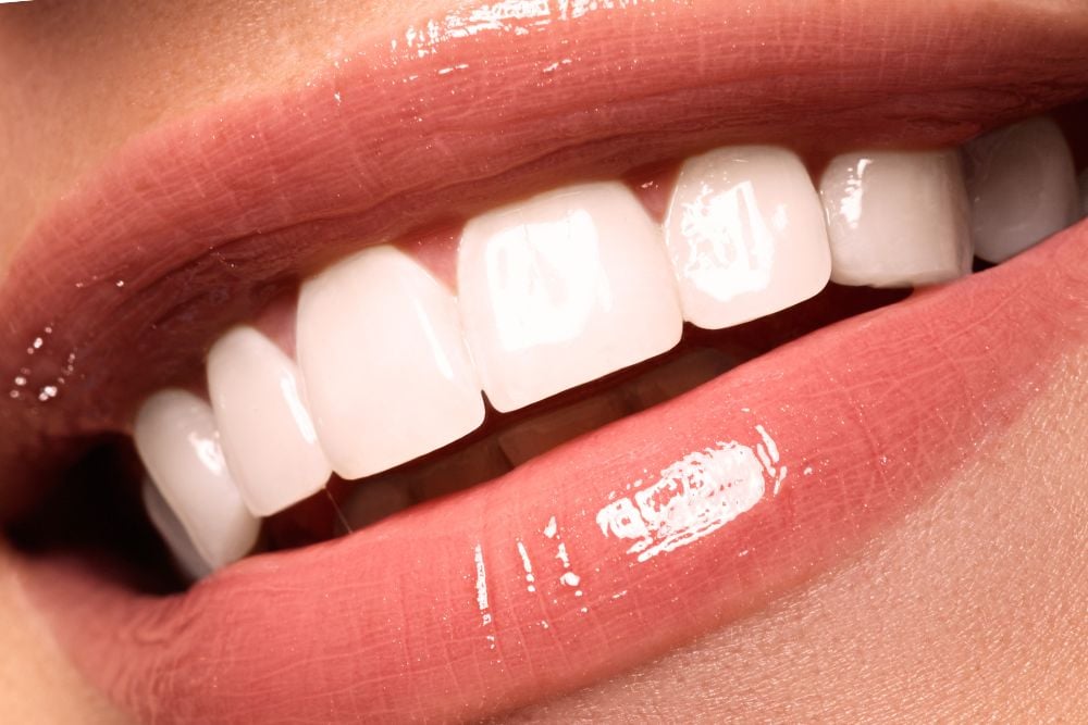 ¿Qué son las tinciones dentales y cómo tratarlas? / Ester Rodriguez Clínica Dental