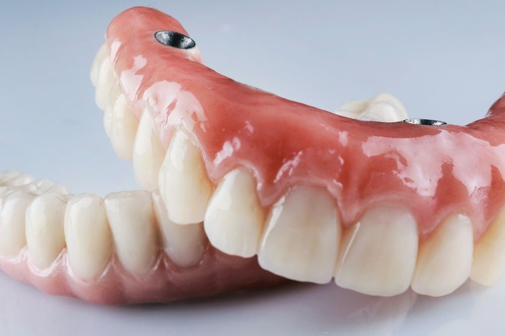 Tipos de prótesis: ¿Cuál es la mejor opción para ti? | Ester Rodríguez Clínica Dental en Salamanca